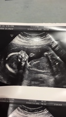 Due Feb 2019 - we’re halfway!