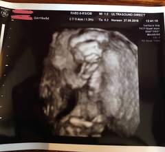 Anyone else have a weird looking 3D scan?