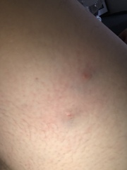 What the F bit me!?!?