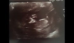 Gender Guesses!!?? 💗💙