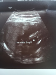 Gender Guesses!!?? 💗💙