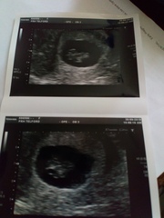 More Christmas Cake! Pregnancy after loss (thread 3)