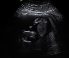 Pregnancy after loss: spring 2019 edition (The Brexit Babes) 🐧