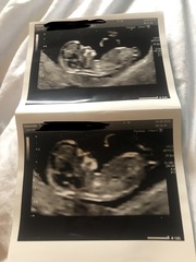 Last minute gender guesses?!