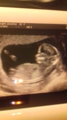 12 week scan