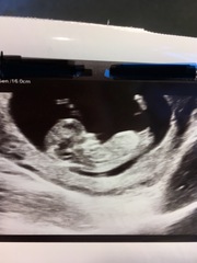 12 week scan - sex guesses