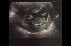 Gender Guesses!!?? 💗💙