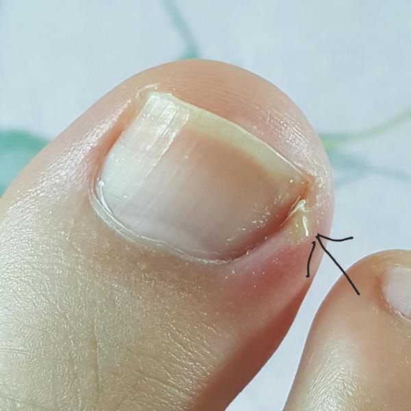 Might not look like much but it's pissing me off.. I need help