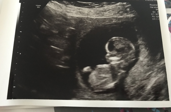 April 2019 babies continued