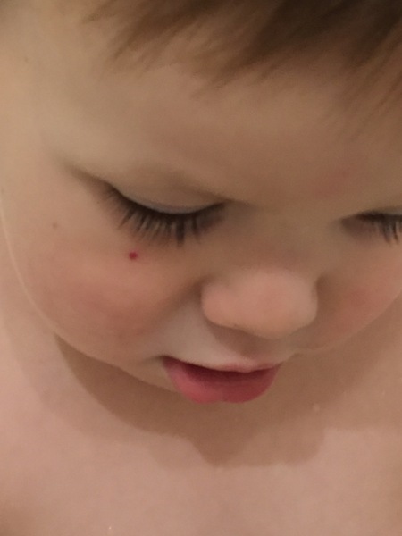 What’s this on my toddlers face??