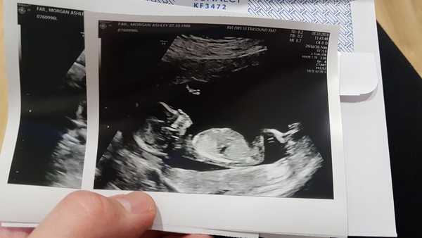 April 2019 babies continued