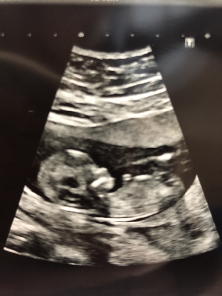 Sex guesses please!!