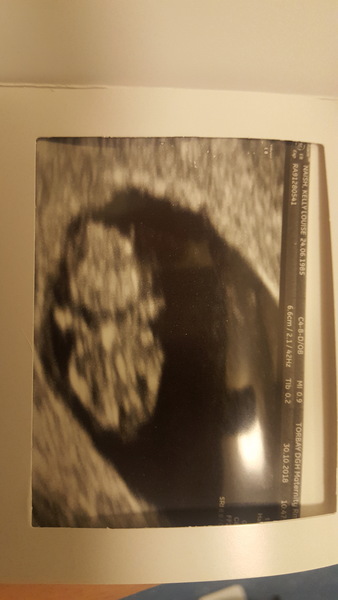 First baby due June 2019!