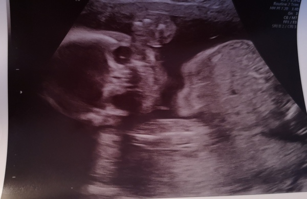 The March-ers 2019 #6