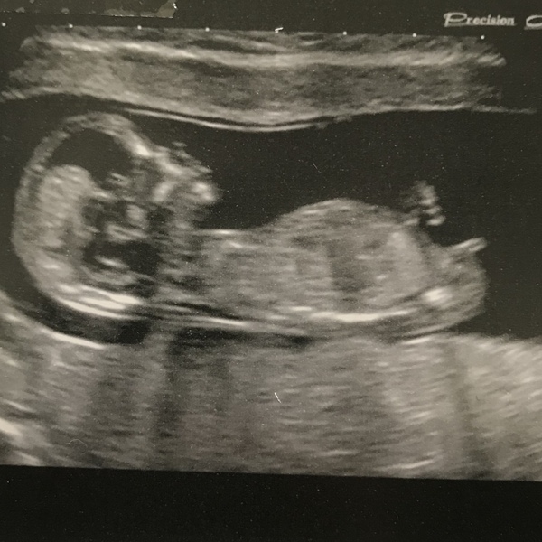 May-ish 2019 - thread 3!