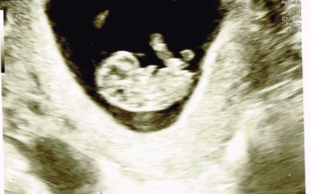 Due May 2019
