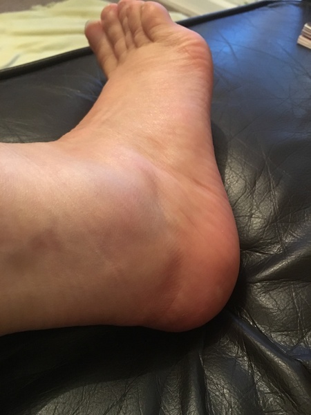 Would anyone mind checking out this foot pic
