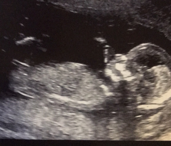 Guess the sex! 💙💗