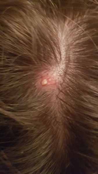 The day my head exploded