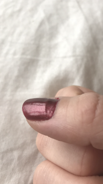 Can anyone see this ridge going across my nail?