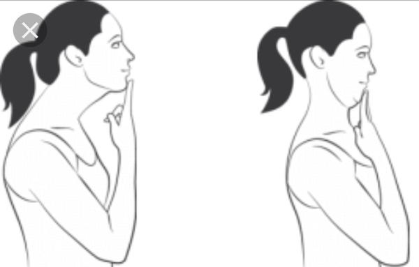 My posture is appalling