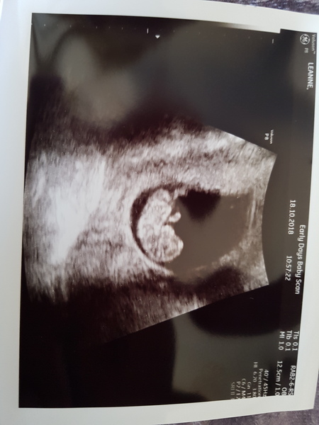 Pregnancy after loss: spring 2019 edition (The Brexit Babes) 🐧