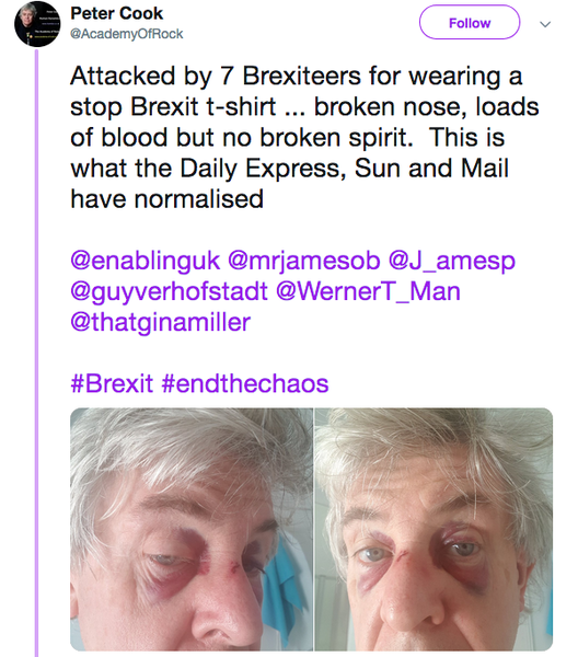 Westministenders: A Change of Mood