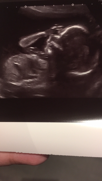 The March-ers 2019 #6