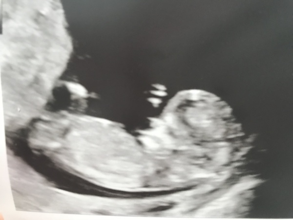 Girl or boy? Guesses appreciated