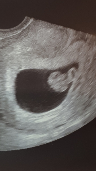 Just got Very first BFP!! Due May 2019 anyone else??