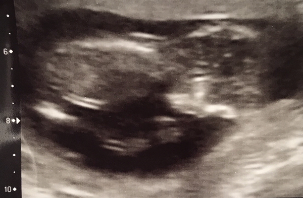 Gender predictions please??