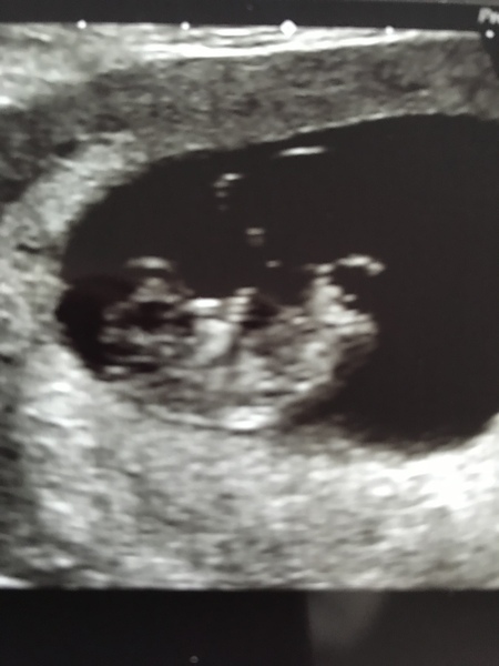 Just got Very first BFP!! Due May 2019 anyone else??