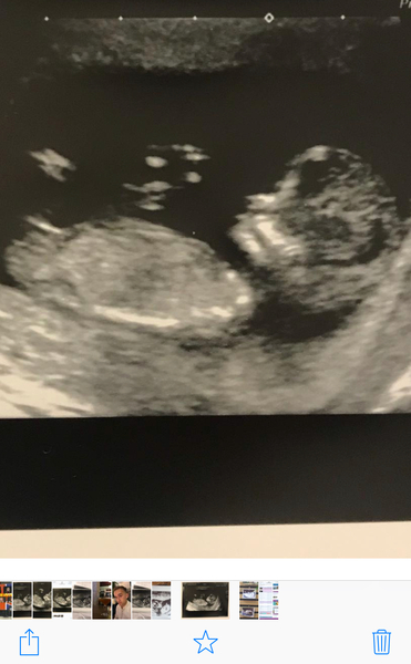 Any guesses of the sex?