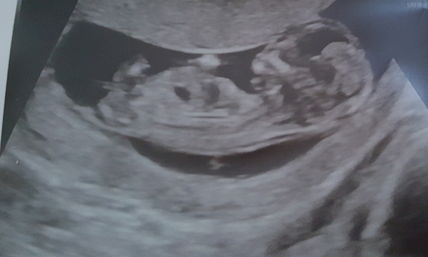 May-ish 2019 - thread 3!