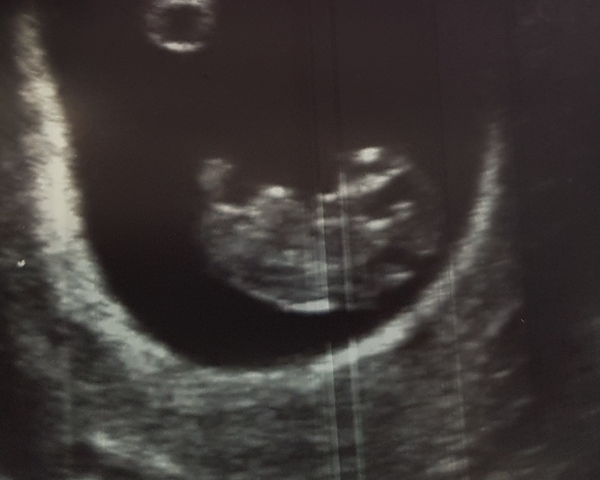 Too early for gender guesses???