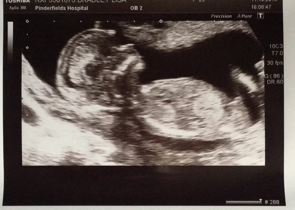 First babies due in April