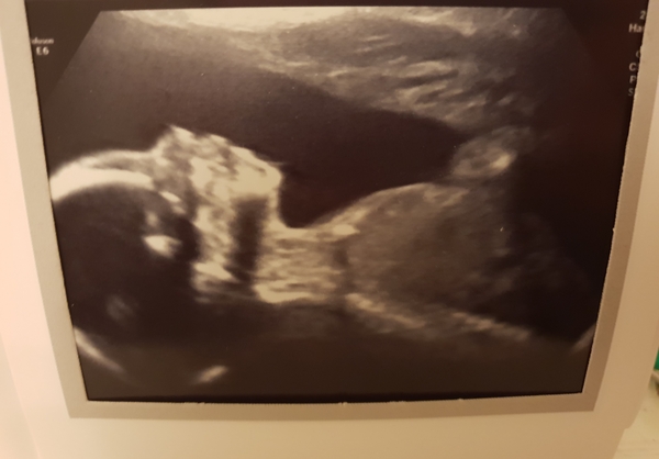 The March-ers 2019 #6