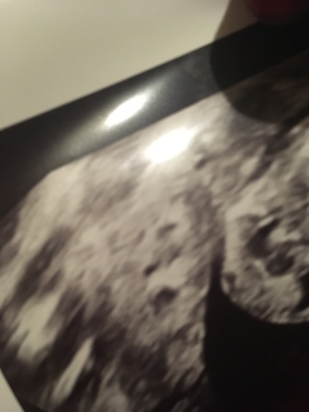 Face in scan picture anyone had this before