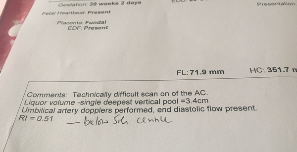 Does anyone know was RI means on an ultrasound scan?