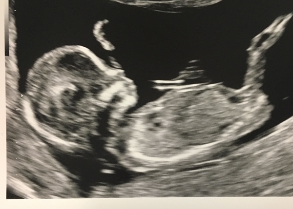 May-ish 2019 - thread 2!