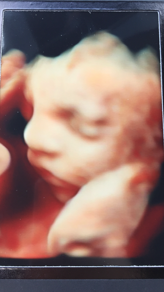 December 2018 Babies - Thread #4