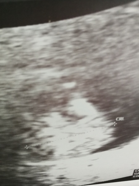 Can't stop crying - baby measuring 8 weeks at 12