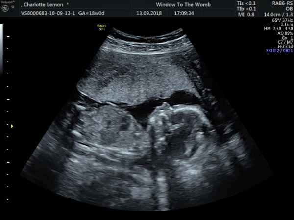 Scan photo, just checking