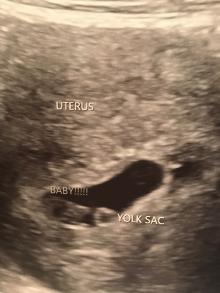 Just got Very first BFP!! Due May 2019 anyone else??