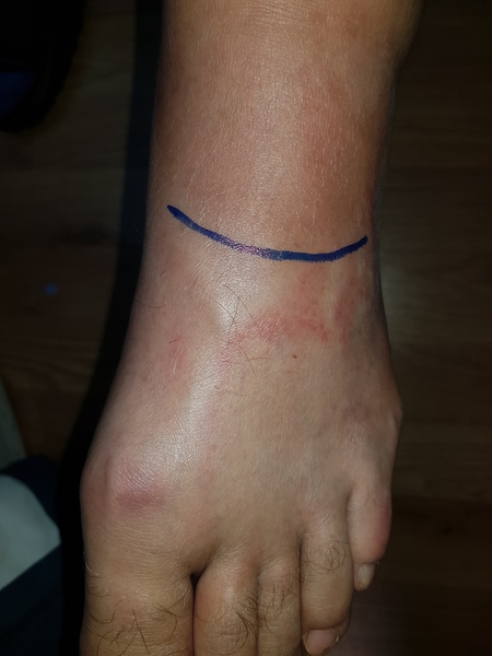 Help me get DH to the doctor's