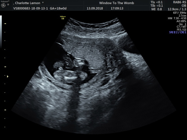 Scan photo, just checking