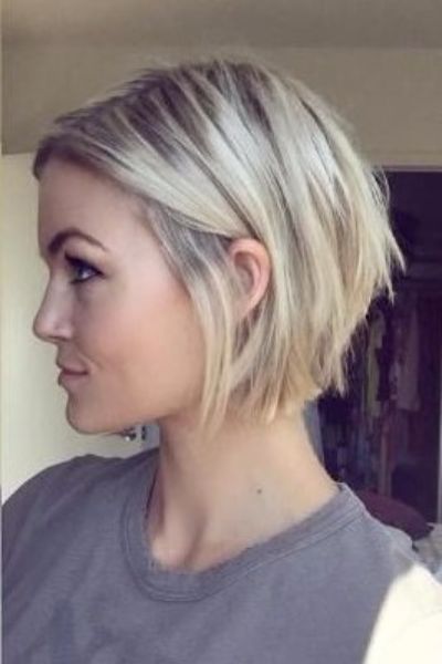 Postpartum hair loss