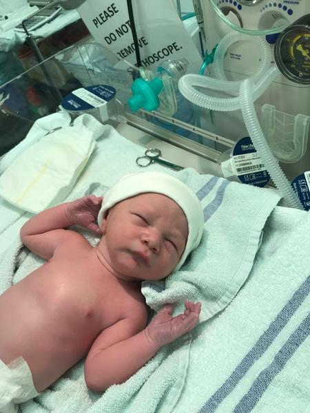 C-Section this Friday- tips?
