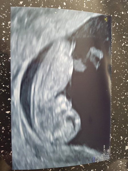 Pregnancy after loss: spring 2019 edition (The Brexit Babes) 🐧