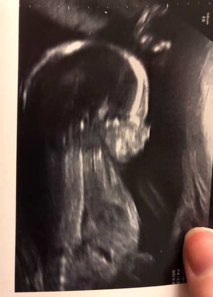 The March-ers 2019 #6